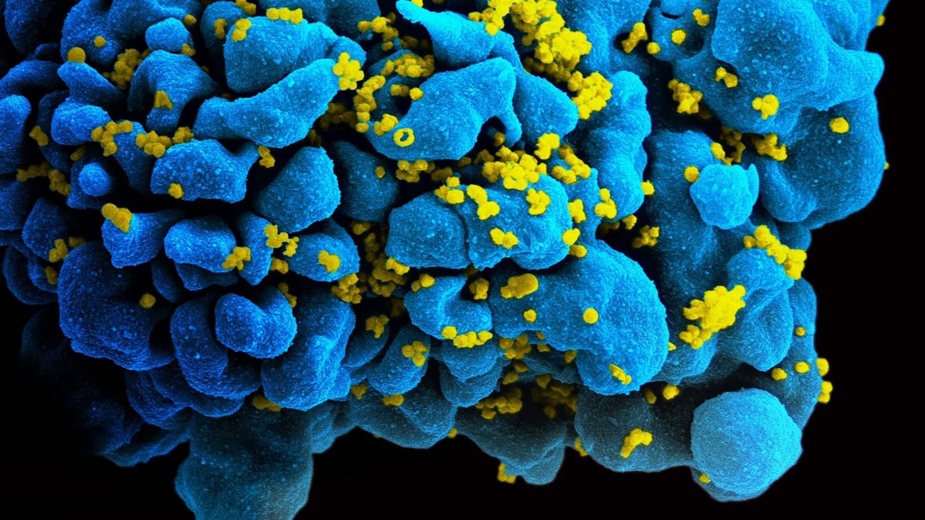 Pew Researcher Seeks to Crack Code on HIV Cure | The Pew Charitable Trusts