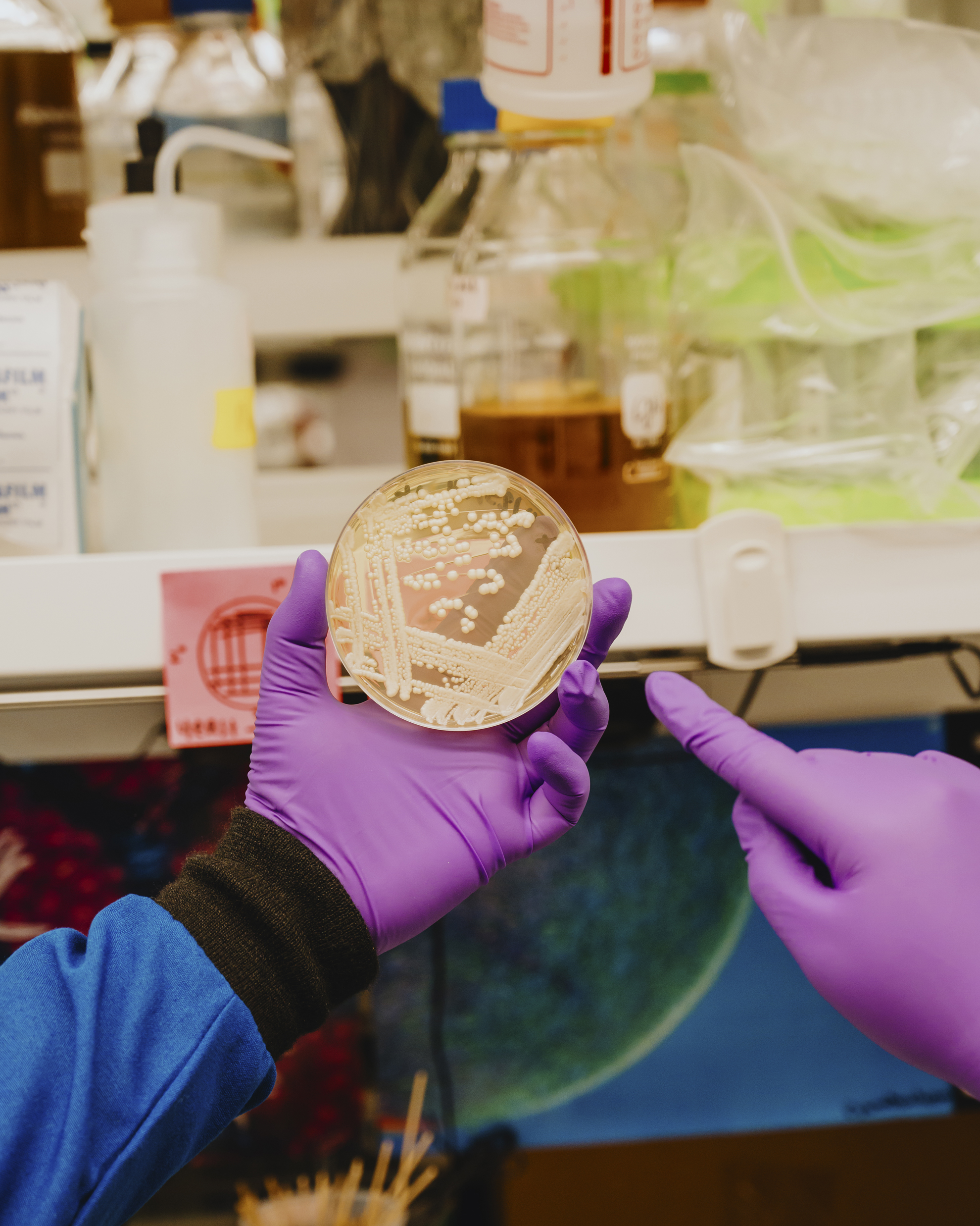 In a lab, purple-gloved hands hold a petri dish bursting with a growing fungal pathogen, which resembles white bubbles.