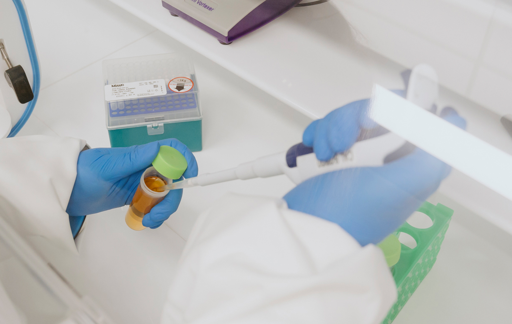 A view from above shows blue-gloved hands using a pipette to place drops of a substance into a test tube full of bright orange liquid.